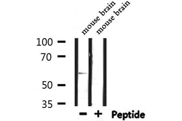 CLK2 antibody  (N-Term)