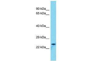 Host: Rabbit Target Name: FAM101B Sample Type: U937 Whole Cell lysates Antibody Dilution: 1. (FAM101B antibody  (N-Term))