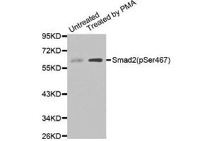 Western blot analysis of extracts of Untreated and treated 293T cell lines, using Phospho-SMAD2-S467 antibody. (SMAD2 antibody  (pSer467))
