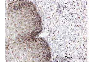 Immunoperoxidase of purified MaxPab antibody to LHX4 on formalin-fixed paraffin-embedded human esophagus. (LHX4 antibody  (AA 1-390))