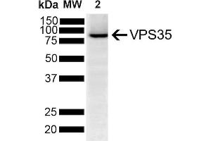 Western Blot analysis of Human SH-SY5Y showing detection of VPS35 protein using Mouse Anti-VPS35 Monoclonal Antibody, Clone 5A9 (ABIN6932942). (VPS35 antibody  (APC))