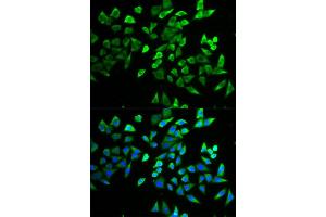 Immunofluorescence (IF) image for anti-Transcription Factor 19 (TCF19) antibody (ABIN1877133)