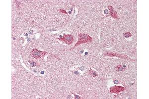 Anti-OPCML / OBCAM antibody IHC staining of human brain, cortex. (OPCML antibody)