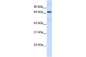 WB Suggested Anti-ACSL5 Antibody Titration:  0. (ACSL5 antibody  (C-Term))