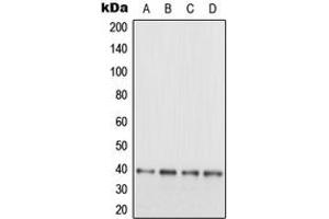 Western blot analysis of EB3 expression in SHSY5Y (A), HeLa (B), SP2/0 (C), PC12 (D) whole cell lysates.