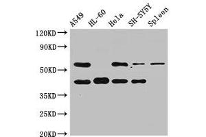 Western Blot Positive WB detected in: A549 whole cell lysate, HL60 whole cell lysate, Hela whole cell lysate, SH-SY5Y whole cell lysate, Rat spleen tissue All lanes: BACE2 antibody at 2. (BACE2 antibody  (AA 84-157))