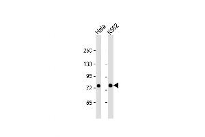 Western Blot at 1:1000 dilution Lane 1: Hela whole cell lysate Lane 2: K562 whole cell lysate Lysates/proteins at 20 ug per lane. (SRP72 antibody  (AA 119-148))