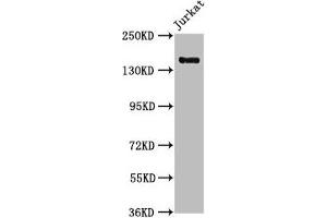Western Blot Positive WB detected in: Jurkat whole cell lysate All lanes: CARMIL2 antibody at 1:1000 Secondary Goat polyclonal to rabbit IgG at 1/50000 dilution Predicted band size: 155, 149 kDa Observed band size: 155 kDa (RLTPR antibody  (AA 1136-1290))