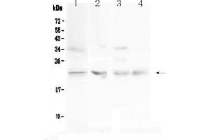 Western blot analysis of TIMP1 using anti-TIMP1 antibody . (TIMP1 antibody  (AA 24-207))