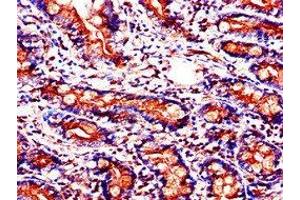 Immunohistochemistry of paraffin-embedded human small intestine tissue using ABIN7153924 at dilution of 1:100 (SLC37A2 antibody  (AA 46-84))