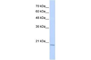 WB Suggested Anti-RBM39 Antibody Titration:  0. (RBM39 antibody  (Middle Region))
