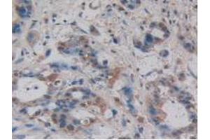 IHC-P analysis of Human Pancreas Tissue, with DAB staining. (Villin 1 antibody  (AA 1-320))