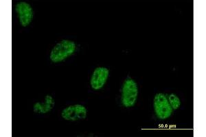 Immunofluorescence of purified MaxPab antibody to SYMPK on HeLa cell. (Symplekin antibody  (AA 1-533))