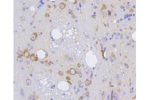 Paraformaldehyde-fixed, paraffin embedded Mouse brain, Antigen retrieval by boiling in sodium citrate buffer (pH6) for 15min, Block endogenous peroxidase by 3% hydrogen peroxide for 30 minutes, Blocking buffer at 37°C for 20min, Antibody incubation with IRF1 (3G7) Monoclonal Antibody  at 1:50 overnight at 4°C, followed by a conjugated secondary and DAB staining. (IRF1 antibody)