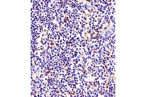 (ABIN6242660 and ABIN6578661) staining beta Tubulin in mouse thymus tissue sections by Immunohistochemistry (IHC-P - paraformaldehyde-fixed, paraffin-embedded sections). (TUBB antibody  (AA 46-78))