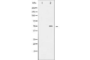 Western Blotting (WB) image for anti-Runt-Related Transcription Factor 1 (RUNX1) (pSer304) antibody (ABIN6256258)