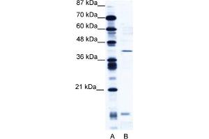 WB Suggested Anti-CREM Antibody Titration:  2. (CREM antibody  (N-Term))
