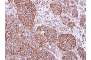 IHC-P Image Immunohistochemical analysis of paraffin-embedded SW480 xenograft, using FBXL2, antibody at 1:500 dilution. (FBXL2 antibody  (N-Term))