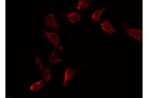 ABIN6269303 staining HuvEc by IF/ICC. (FOXO4 antibody  (C-Term))