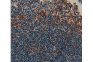 #VALUE! (KLRK1 antibody  (AA 92-216))