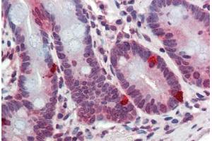 Human Small Intestine: Formalin-Fixed, Paraffin-Embedded (FFPE) (ARL2 antibody  (AA 123-184))