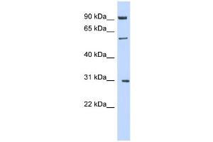 WB Suggested Anti-MGAT2 Antibody Titration:  0. (MGAT2 antibody  (Middle Region))