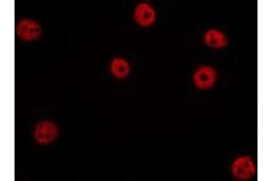 ABIN6275736 staining HepG2 by IF/ICC. (IKZF4 antibody  (C-Term))