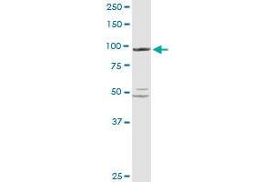 PYGL MaxPab rabbit polyclonal antibody. (PYGL antibody  (AA 1-847))