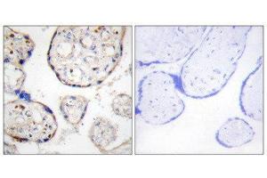 Immunohistochemistry (IHC) image for anti-STEAP Family Member 4 (STEAP4) (Internal Region) antibody (ABIN1849702) (STEAP4 antibody  (Internal Region))