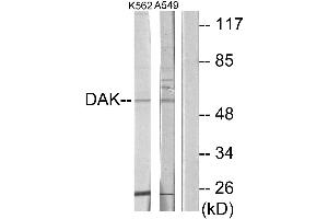 Western blot analysis of extracts from K562 cells and A549 cells, using DAK antibody. (DAK antibody  (Internal Region))