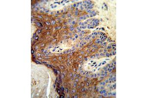 Formalin-fixed and paraffin-embedded human skin tissue reacted with ALOX12 Antibody (C-term), which was peroxidase-conjugated to the secondary antibody, followed by DAB staining. (ALOX12 antibody  (C-Term))