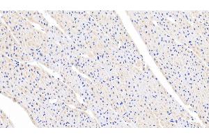 Detection of FGF1 in Porcine Cardiac Muscle Tissue using Polyclonal Antibody to Fibroblast Growth Factor 1, Acidic (FGF1) (FGF1 antibody  (AA 12-151))