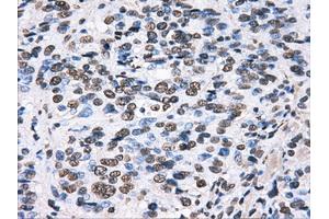 Immunohistochemical staining of paraffin-embedded pancreas tissue using anti-HDAC10mouse monoclonal antibody. (HDAC10 antibody)