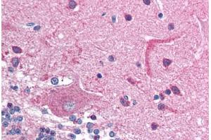 Human Brain, Cerebellum (formalin-fixed, paraffin-embedded) stained with HDAC6 antibody ABIN214772 at 5 ug/ml followed by biotinylated goat anti-rabbit IgG secondary antibody ABIN481713, alkaline phosphatase-streptavidin and chromogen. (HDAC6 antibody  (AA 69-118))