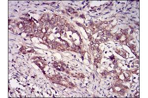 Fig. (CSNK2B antibody  (AA 1-215))