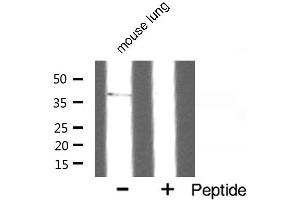 Western blot analysis of SUCNR1 expression in mouse lung. (SUCNR1 antibody  (Internal Region))