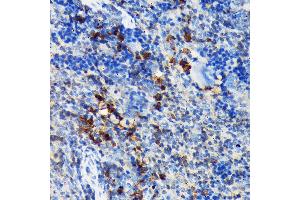Immunohistochemistry (IHC) image for anti-C-Src tyrosine Kinase (CSK) antibody (ABIN1513217)