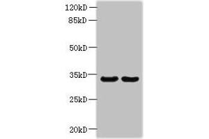 Western blot All lanes: ROGDI antibody at 1.