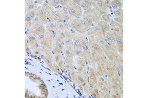 Immunohistochemistry of paraffin-embedded human liver using IL5 antibody (ABIN5975164) at dilution of 1/100 (40x lens). (IL-5 antibody)