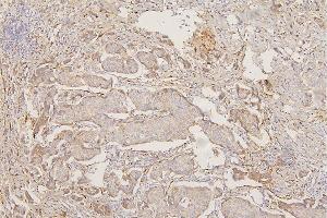 IHC analysis of Collagen III/COL3A1 using anti-Collagen III/COL3A1 antibody (ABIN6719296).