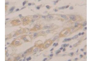 IHC-P analysis of Human Stomach Tissue, with DAB staining. (Peroxiredoxin 2 antibody  (AA 6-164))