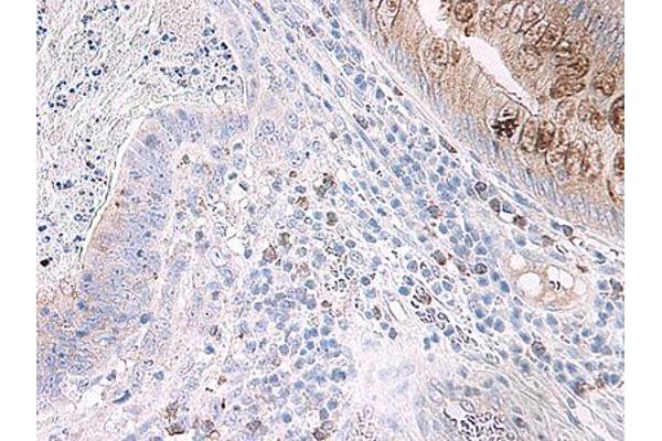 CCL15 antibody