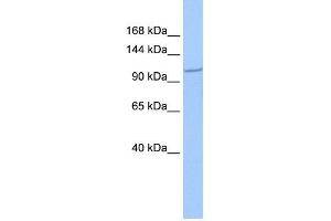 WB Suggested Anti-IFT122 Antibody Titration: 0.