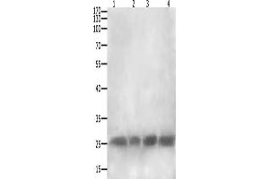 Gel: 12+15 % SDS-PAGE, Lysate: 40 μg, Lane 1-4: RAW264. (CLEC4A antibody)