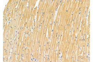 ABIN6265808 and ABIN6272545 at 1/100 staining Rat heart tissue by IHC-P.