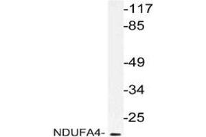 Western blot: analysis of NDUFA4 antibody staining in extracts from RAW264. (NDUFA4 antibody)