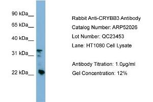 WB Suggested Anti-CRYBB3  Antibody Titration: 0. (CRYBB3 antibody  (Middle Region))