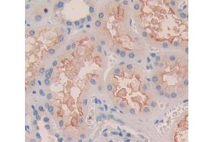 Used in DAB staining on fromalin fixed paraffin- embedded Kidney tissue (ITGA8 antibody  (AA 907-1063))