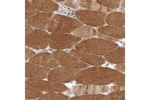 Immunohistochemical staining of human skeletal muscle with LRP5L polyclonal antibody  shows moderate cytoplasmic positivity in myocytes at 1:10-1:20 dilution. (LRP5L antibody)
