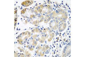 Immunohistochemistry of paraffin-embedded human stomach using PLS3 antibody (ABIN5971877) at dilution of 1/100 (40x lens).